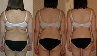 Načini da izgubite 7 kg za nedelju dana